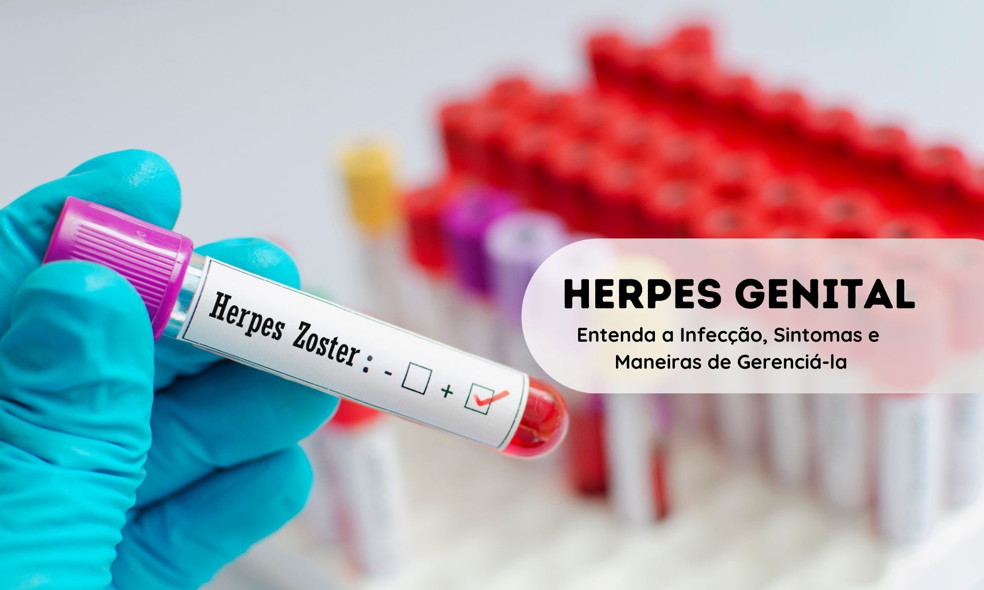 Herpes Genital