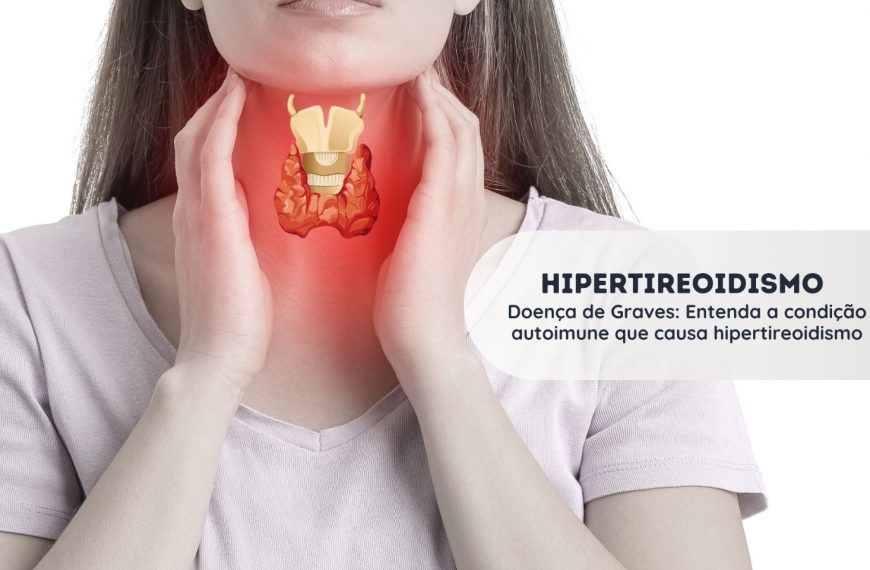 Doença de Graves – Hipertireoidismo