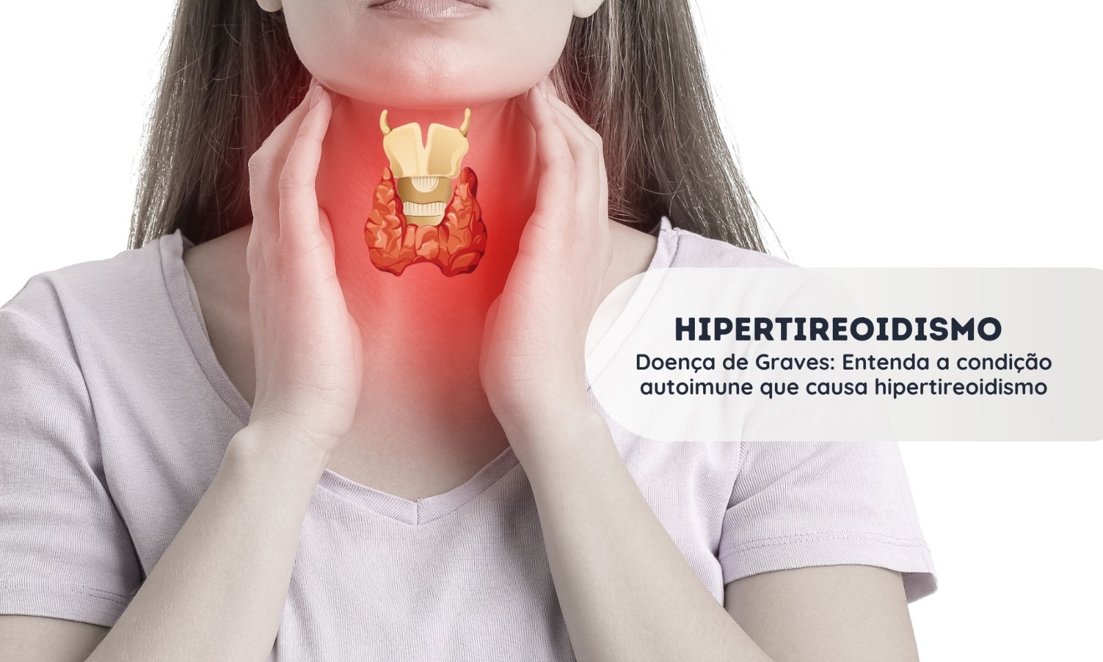 Doença de Graves – Hipertireoidismo