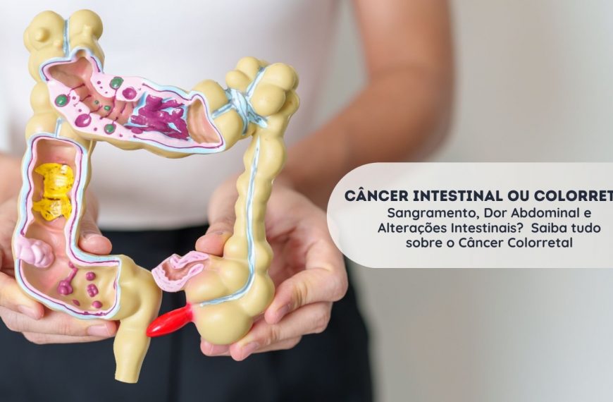 Câncer Intestinal ou Colorretal