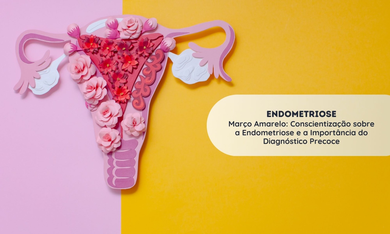 Endometriose