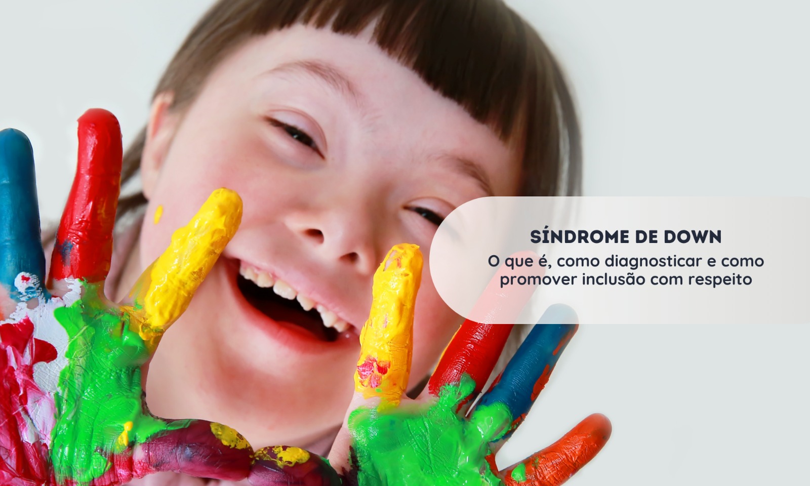 Síndrome de Down