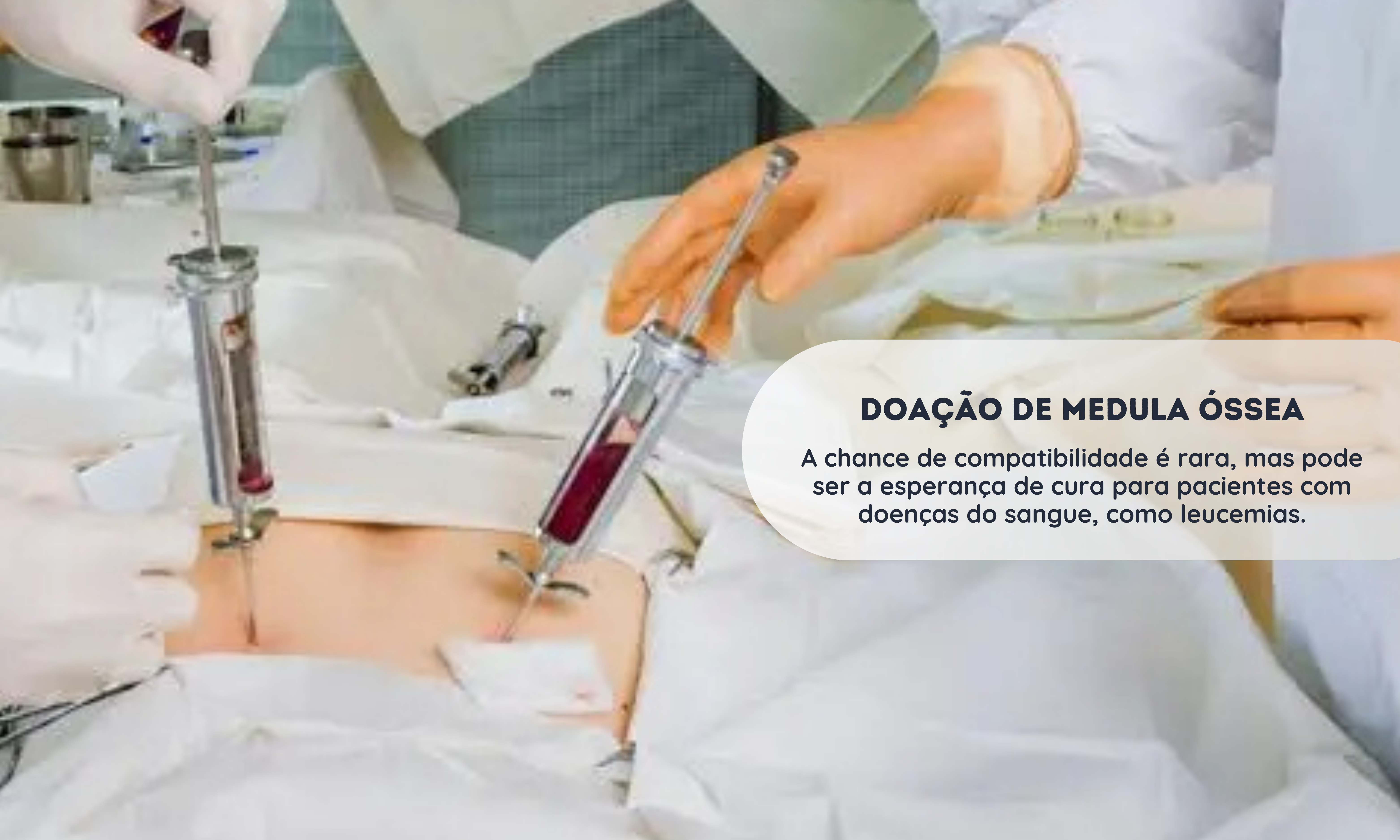 Doação de Medula Óssea