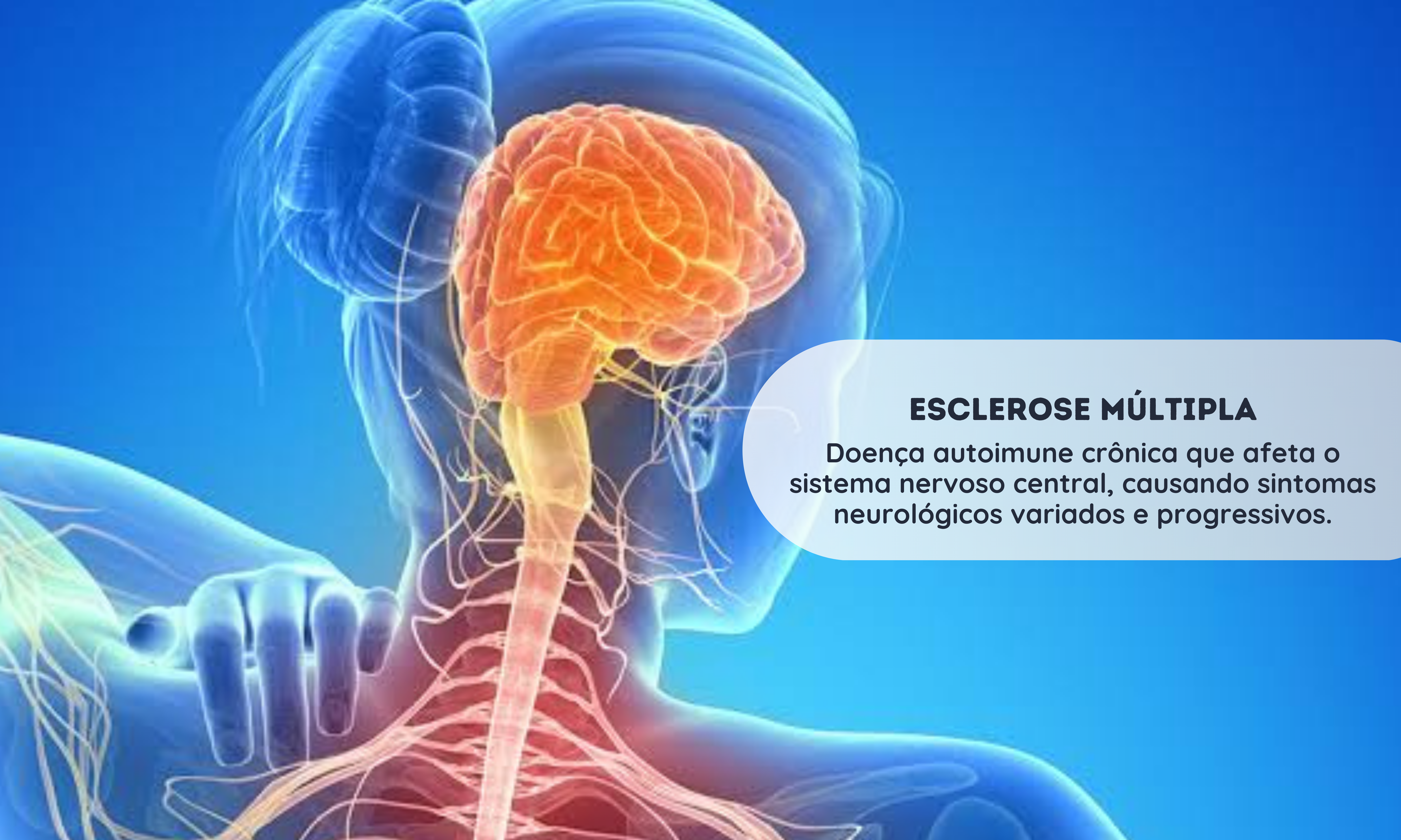 Esclerose Múltipla (EM)
