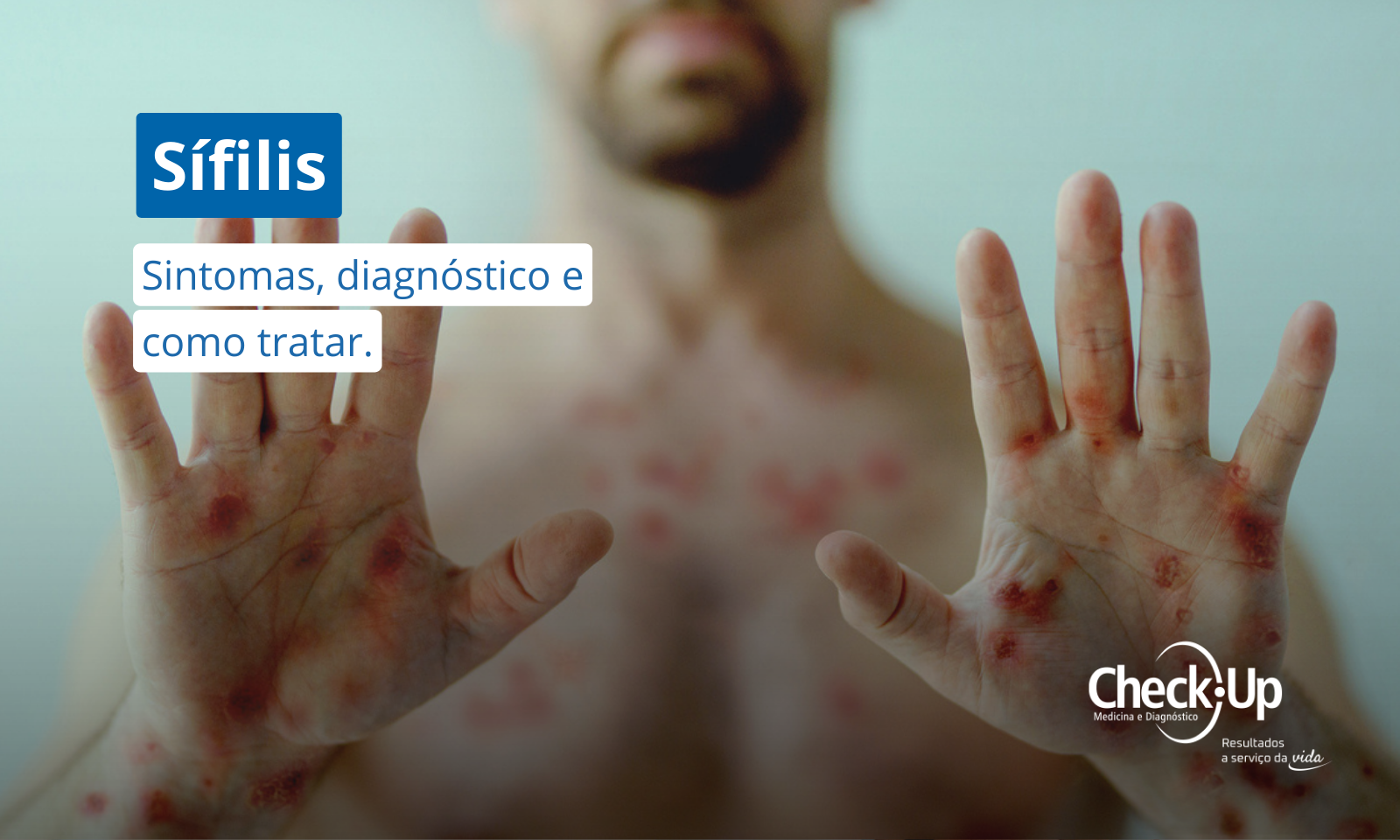 Diagnóstico Sorológico da Sífilis